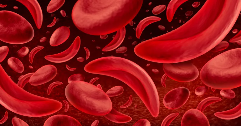DNA strand with red blood cells representing gene therapy in sickle cell