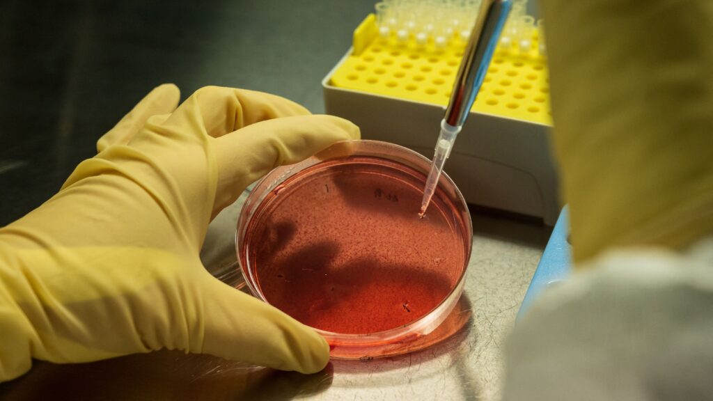 A depiction of a customized vaccine targeting kidney cancer cells