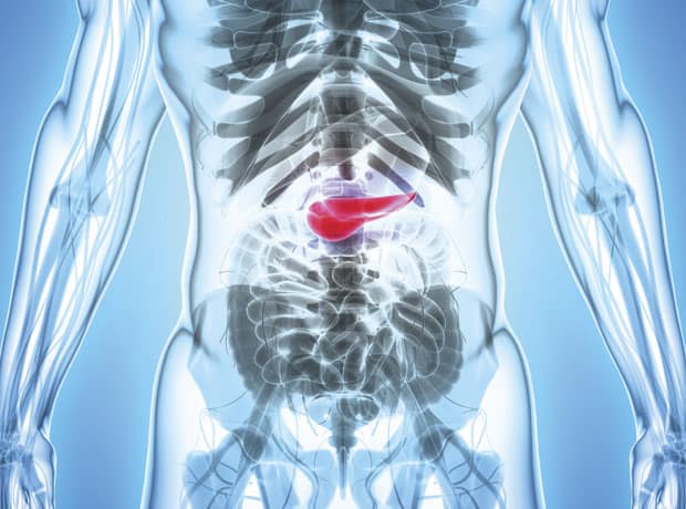 Advancements in pancreatic cancer therapy