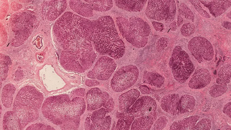 A liver model showing signs of recovery and regrowth