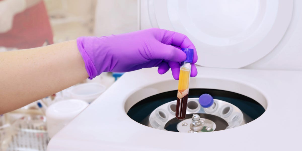 Abstract image of plasma exchange therapy