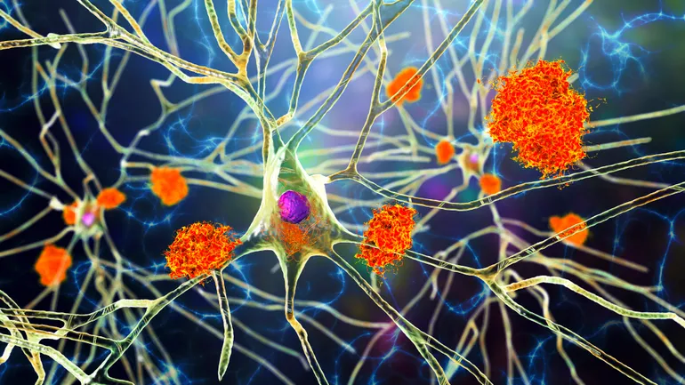 Brain neurons with synaptic connections