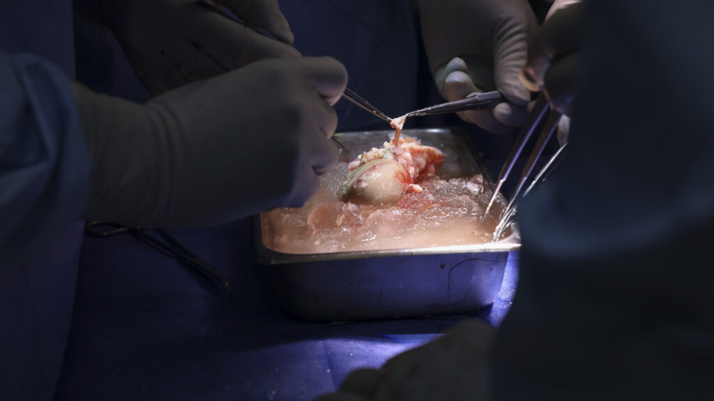 A close-up of a genetically modified pig and a human hand reaching toward each other, symbolizing medical advancement.
